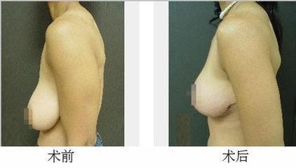 乳房在线咨询，女性健康守护的重要渠道